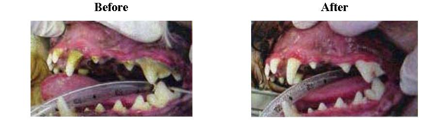 Before and After Dental Cleaning